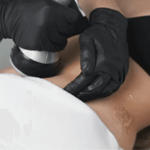 ULTRASOUND/RF TREATMENT at Aurora Rose Beauty Spa in Fayetteville, NC